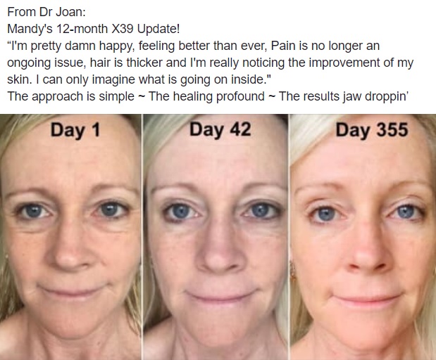 skin results from x39